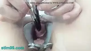 فحص شرجي بدون قفازات يصبح حميميًا